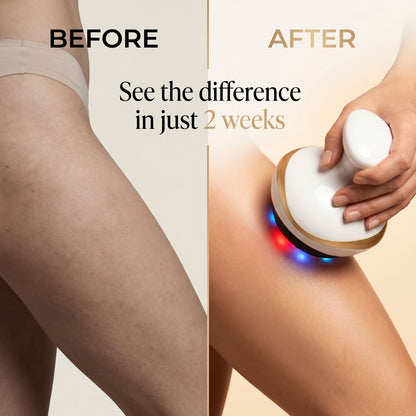 Neurothlet VacuShaper