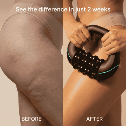 Neurothlet Rollshaper