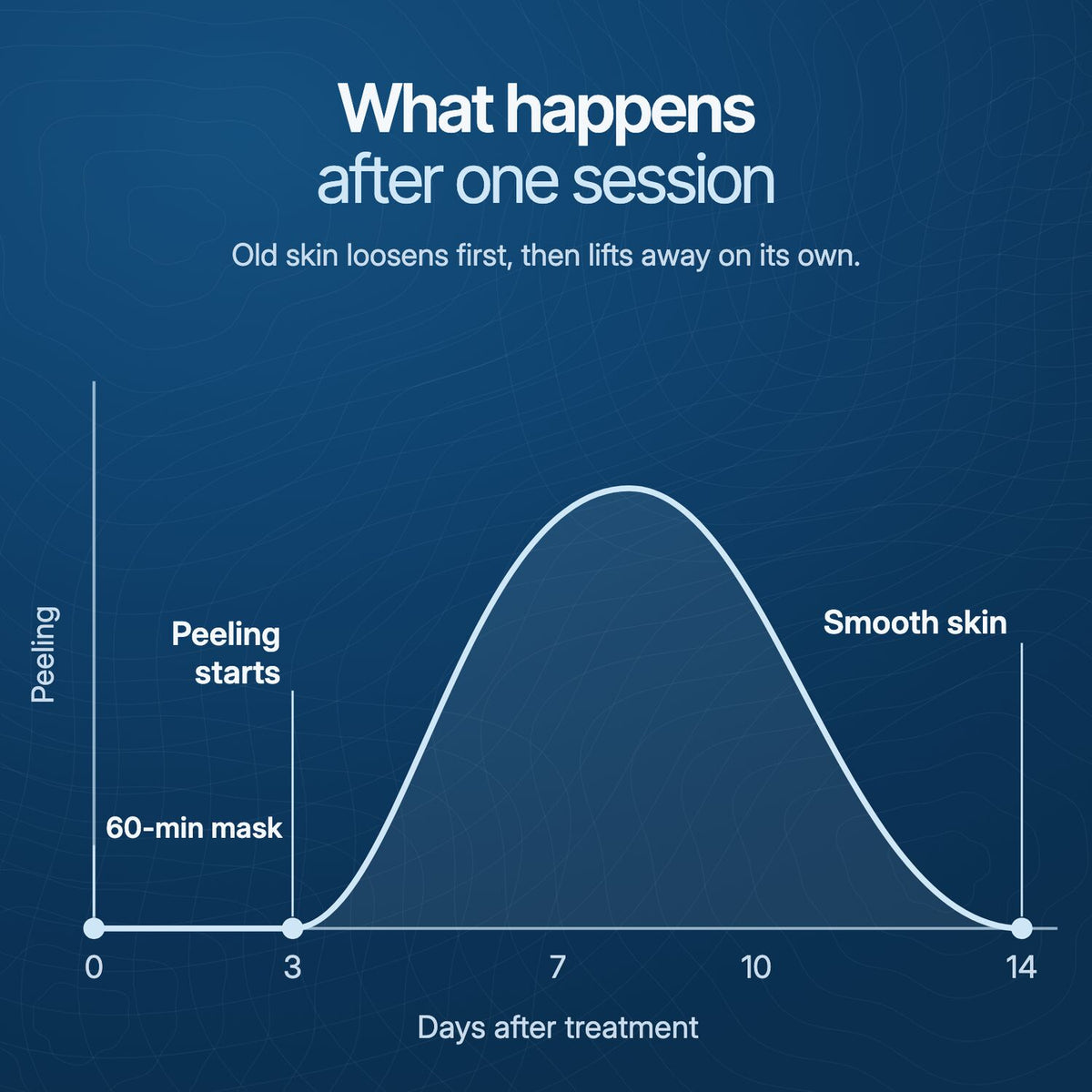 What happens after one session: peeling starts around day 3, smooth by day 14