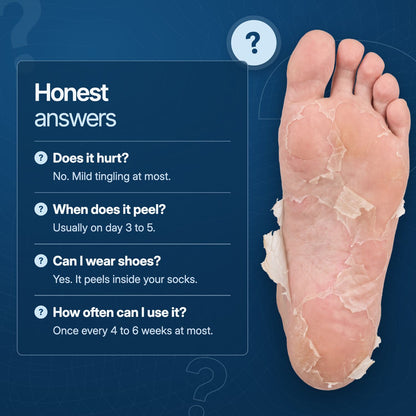 Honest answers about the foot mask, with a peeling sole